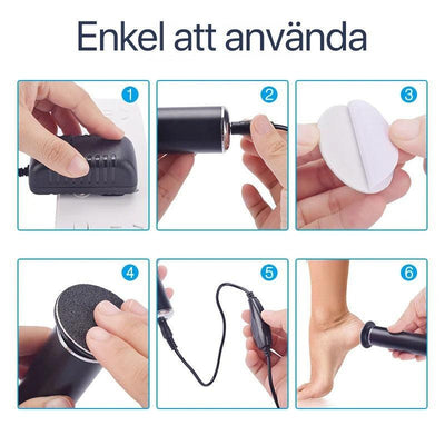 Bruksanvisning i seks trinn for den elektriske hard hud-fjerneren